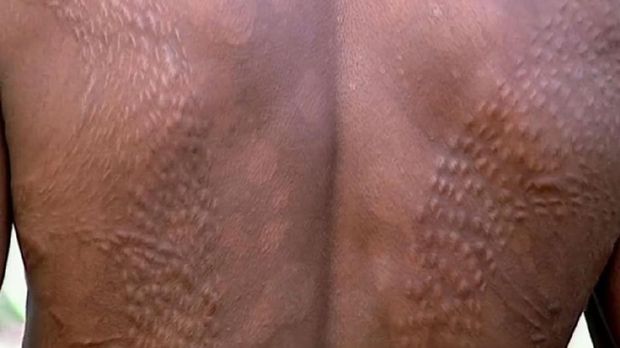 Aw! Tradisi Ini Dianggap Paling Menyakitkan di Dunia