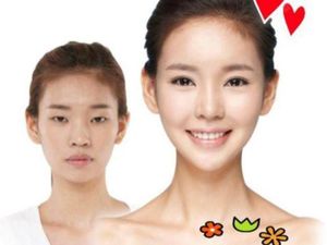 Perubahan Drastis Wanita Korea yang Operasi Plastik Kelopak Matanya