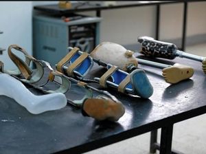 Kehilangan Kaki Karena Kanker, Pria Ini Jadi Pembuat Kaki Palsu