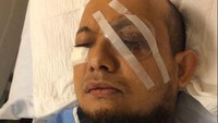 Pada Agustus 2017, Novel Baswedan menjalani operasi di mata kiri. Begini kondisinya di RS saat menjalani perawatan usai operasi (Foto: dok. Istimewa)