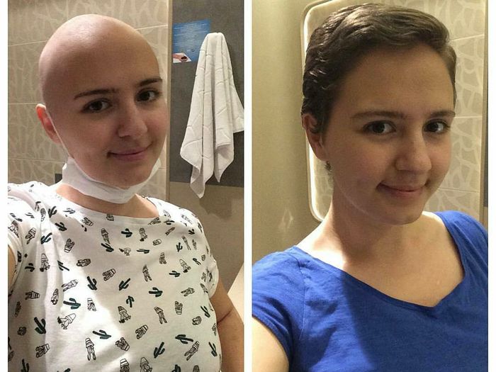 Transformasi Para Penyintas Kanker Dari Botak Dan Pucat Kembali Cantik Transformasi Para Penyintas Kanker Dari Botak Dan Pucat Kembali Cantik