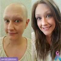 Kanker Otak Penyebab Agung Hercules Botak Dan Kurus Tagar