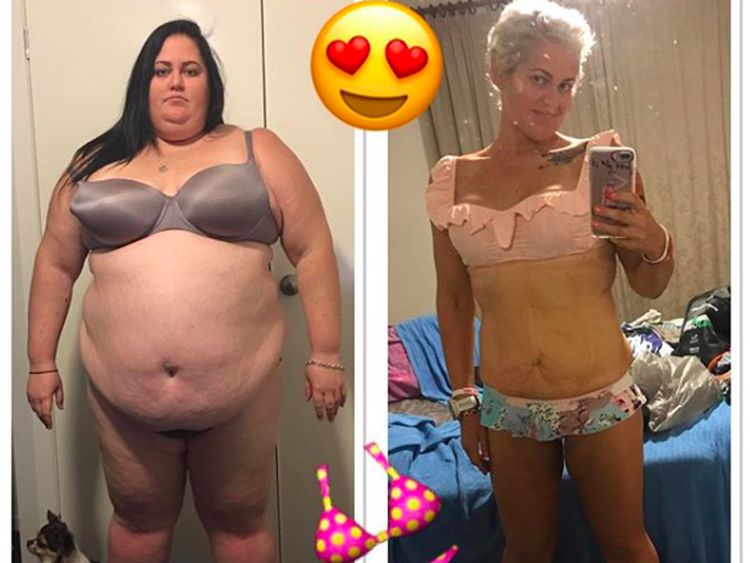 Foto: Diprediksi Tak Berumur Panjang Jadi Motivasi Turunkan Bobot 115 kg