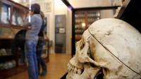 Menurut teorinya kriminologi antropologi dan kriminologi positivis, bahwa sifat jahat adalah semacam kemunduran evolusioner, secara fisik tidak berkembang. Sayangnya bagi mereka-mereka yang mengalami hal-hal tersebut tidak dapat berubah, karena itu adalah bagian dari biologis mereka (Foto: Stefano Rellandini/Reuters)