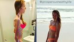 Foto Transformasi Para Wanita Anoreksia: Dari Kurus Kering Kembali Berisi