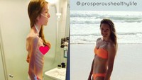 Dari prevalensinya anoreksia diketahui lebih banyak diidap oleh wanita dibandingkan pria. Kemungkinan karena citra badan ideal lebih ditekankan untuk kaum wanita. (Foto: Instagram/herculesworkouts)