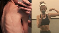 Bila dibiarkan seorang penyandang anoreksia akan terus mengurus lalu bisa mengalami berbagai komplikasi kesehatan yang berujung fatal. (Foto: Instagram/monicasfitness_)
