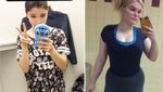 Foto Transformasi Para Wanita Anoreksia: Dari Kurus Kering Kembali Berisi