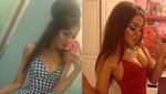 Foto Transformasi Para Wanita Anoreksia: Dari Kurus Kering Kembali Berisi