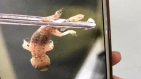 Potret Operasi Pengangkatan Cicak Hidup dari Telinga Pria asal China