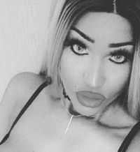 Diselingkuhi Tunangan, Wanita Ini Rogoh Rp 171 Juta Oplas Mirip Boneka Seks