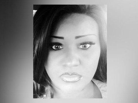 Diselingkuhi Tunangan, Wanita Ini Rogoh Rp 171 Juta Oplas Mirip Boneka Seks