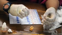 Berdasarkan data dari Dinas Kesehatan Subang, penderita HIV di wilayah ini hingga saat ini ada 1.564 kasus yang merupakan 5 terbesar di Propinsi Jawa Barat.