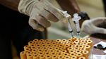 Warga Subang Antusias Memeriksakan HIV/Aids