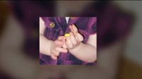 Anak perempuan pertama mereka mengalami pre-axial polydactyly atau memiliki 2 ibu jari di satu tangan. Sementara anak kedua mereka mengalami bibir sumbing. 