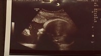 Saat pemeriksaan USG, ada penampakan ‘Yesus’ tengah menatap si jabang bayi.