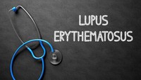 Dikatakan dr Febrina, penyakit autoimun seperti lupus (Discoid Lupus Erythematosus) juga ditandai adanya sariawan di rongga mulut. Misal yang terkait dengan imun, lupus itu juga ada tanda sariawan di dalam mulut, kata dr Febrina. (Foto: Thinkstock)