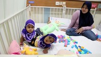 Ketua Tim Kembar Siam RSHS Sjarif Hidajat Effendi menyebut operasi menghilangkan kaki tambahan itu bisa segera berlangsung dan tidak membutuhkan waktu lama. Sebab tindakan medis yang dilakukan dokter kepada kembar siam ini termasuk operasi kecil. (dok. RSHS Bandung)