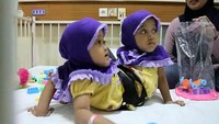 Kaki tambahan telah mengganggu aktivitas bocah kembar berusia 3 tahun 11 bulan tersebut sehingga akan dibedah dokter.  (dok. RSHS Bandung)
