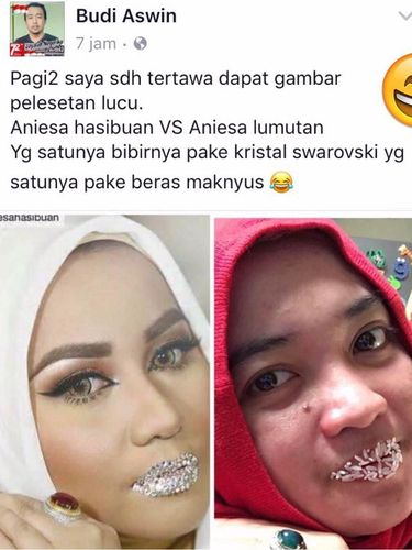 Bibir Kristal Anniesa Hasibuan Jadi Viral, Netizen Tiru Pakai Beras