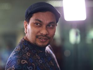Tompi Ingatkan Jangan Anggap Operasi Hidung Seperti Belanja Barang