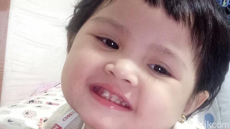 Ilustrasi gigi anak goyang karena jatuh/ Foto: dok.HaiBunda Ilustrasi gigi anak goyang karena jatuh/ Foto: dok.HaiBunda
