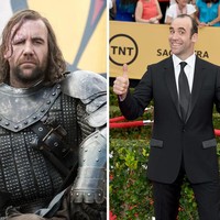 Rory McCann, pemeran The Hound tak punya bekas luka bakar di kehidupan nyata. Ia juga tampil rapi tanpa kumis dan janggut.  
