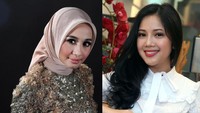 Nah jika biasanya foto Instagram sudah banyak polesan sana-sini, sekarang detikHOT beri foto asli keduanya yang tanpa diolah banyak tools. Silakan menilai cantik mana ya! Foto: dok detikHOT