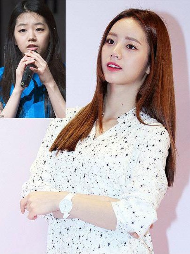 Personel termuda girlband Girl’s Day, Lee Hye-ri, penampilannya sangat berbeda ketika belum terkenal dan melakukan operasi plastik. Operasi plastik pada daerah mata dan hidung membuat wanita 23 tahun itu kini cantik memesona. Foto: Dok. K-Pop.Map, Instagram