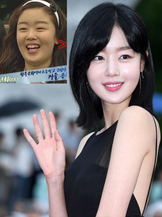 Han Sun Hwa merupakan personel girlband Secret. Artis yang juga pernah membintangi serial Korea, Marriage, Not Dating itu tampak sangat berbeda sebelum dan sesudah operasi plastik. Selain matanya yang lebih besar, hidungnya pun jadi lebih mungil. Foto: Dok. K-Pop.Map, Instagram