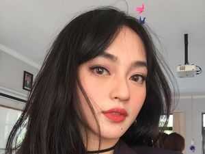 Kalau Sakit Mata, Nanti Berobat Ke Dokter Cantik Ini Saja