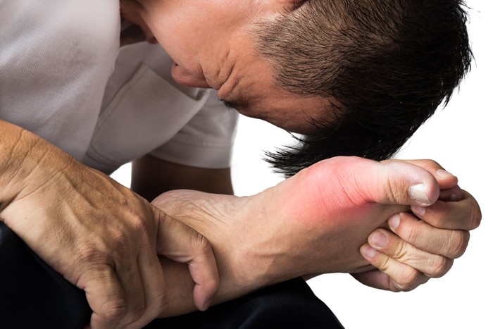 A man suffering from painful and inflamed gout on his right foot around the big toe area.