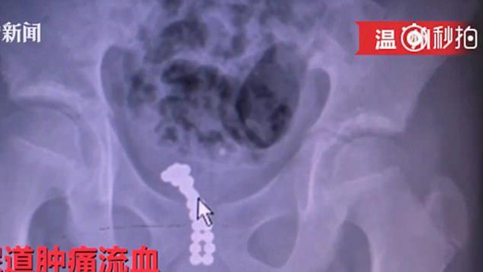 Foto: weibo Foto: weibo
