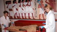 Musee dAnatomie Testut Latarjet alias Testut-Latarjet Museum dikenal dengan sebutan museum paling horor di dunia. Bukan karena penampakan atau cerita mistis, tapi karena koleksinya yang bisa bikin kita bergidik ngeri! (Musee Testut Latarjet/ Facebook)