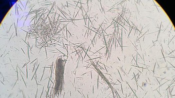 Kristal asam urat dapat dicegah dengan mengonsumsi air putih yang cukup setiap harinya. Foto: Instagram