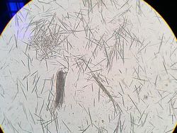 Cantik Tapi Mengerikan, Kristal Asam Urat di Bawah Lensa Mikroskop