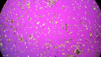 Hasil fotonya cantik, tapi diam-diam berbahaya. Foto: Instagram