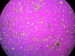 Cantik Tapi Mengerikan, Kristal Asam Urat di Bawah Lensa Mikroskop