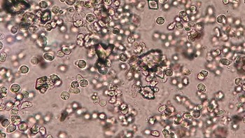 Ayo jaga kesehatan mulai dari sekarang. Foto: Instagram