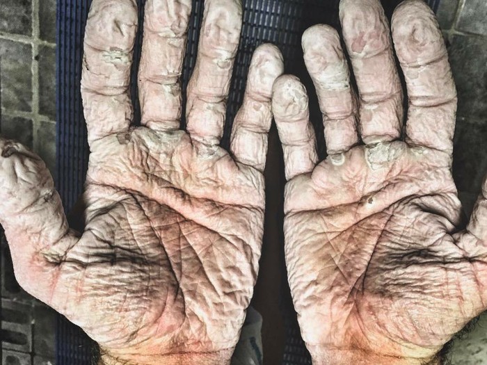 Tebak Tangan Ini Milik Siapa! yang Jelas Bukan Tangan Lansia