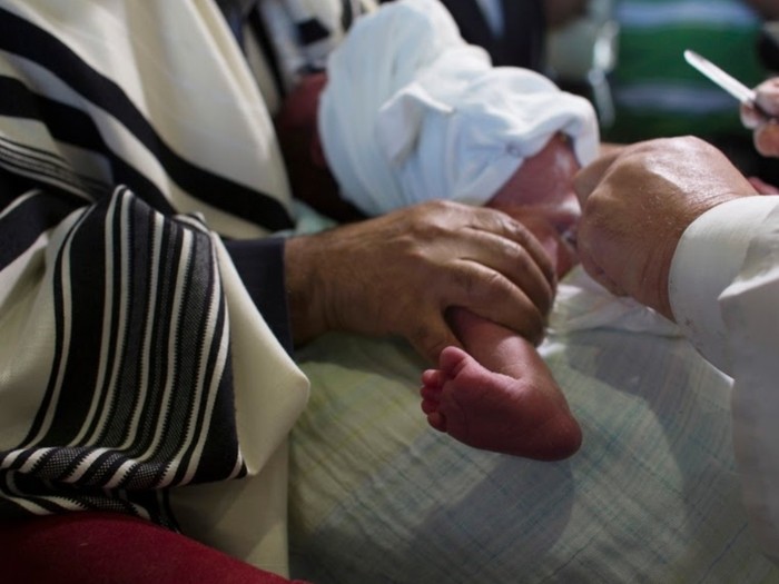 Ritual sunat di Israel. (Foto: Ronen Zvulun/Reuters) Ritual sunat di Israel. (Foto: Ronen Zvulun/Reuters)