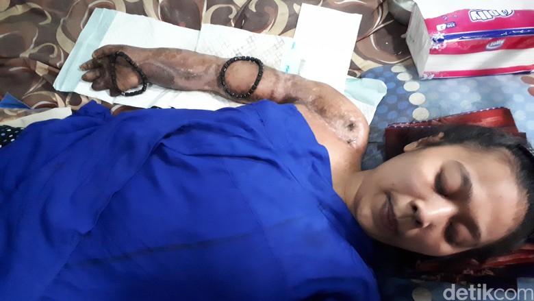 Kisah Pilu Mira: Terlindas Truk, Tunangan Kabur dan Ayah Meninggal Kisah Pilu Mira: Terlindas Truk, Tunangan Kabur dan Ayah Meninggal