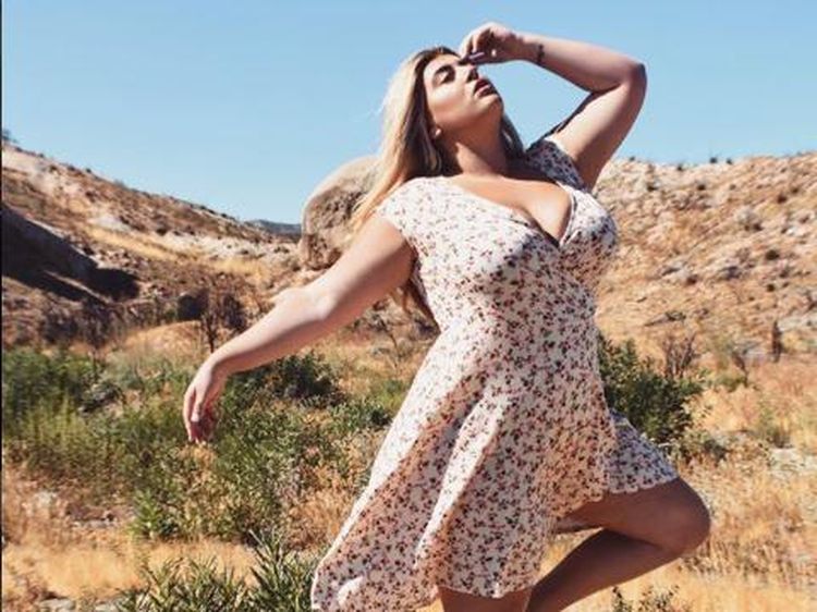Banggakan Tubuhnya, Model Cantik Ini Malah Dituding Promosikan Obesitas