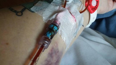 Foto-foto Ini Buktikan Anemia Tidak Boleh Disepelekan