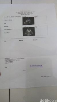 Ini Hasil Pemeriksaan Jantung Bayi Debora yang Terbaru