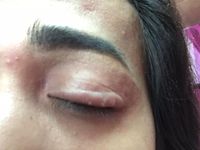 Hati-hati Pakai Kosmetik Palsu Kalau Tak Mau Menderita Seperti Wanita Ini