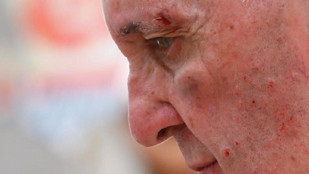 Luka-luka terlihat jelas di wajah Paus Fransiskus 