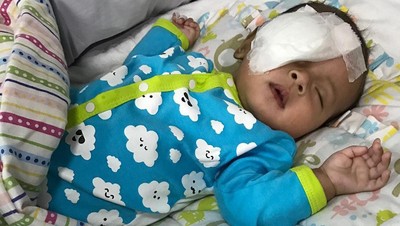 6 Gejala Katarak Anak Seperti yang Dialami Putra Asri Welas