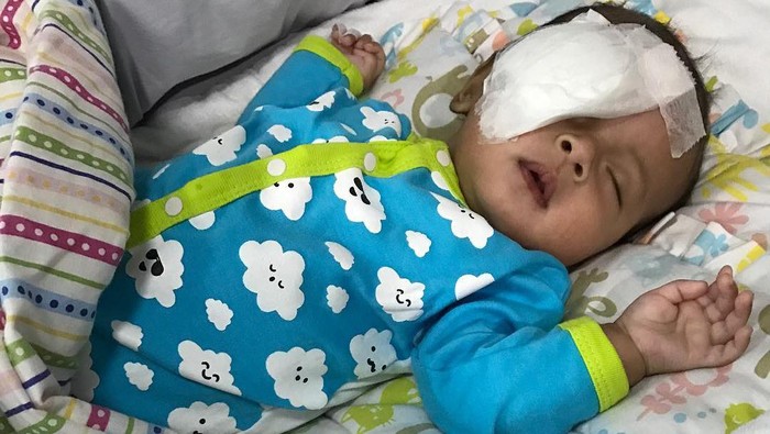 Bayi bisa saja terkena katarak. Foto: instagram Bayi bisa saja terkena katarak. Foto: instagram