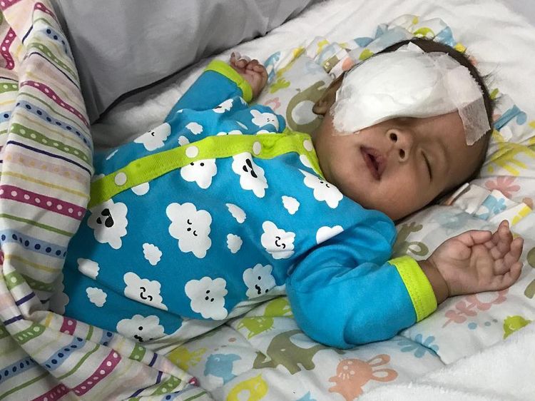 6 Gejala Katarak Anak Seperti yang Dialami Putra Asri Welas